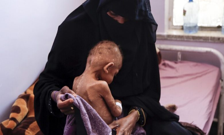 BM'den Yemen'de 18 milyondan fazla insanın şiddetli açlık çektiği uyarısı
