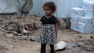 UNICEF: Yemen'de 5 yaş altı 2,2 milyon çocuk, akut yetersiz beslenme sorunu yaşıyor